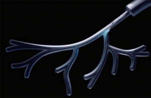 Intuitive Surgical robotic assisted surgery Ion system lung cancer biopsy